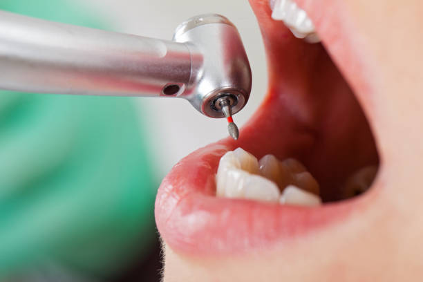 Best Dentist for Tooth Abscess  in Noroton Heights, CT